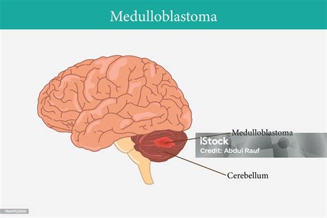 10 200 Royal Parade Pictures Stock Photos Pictures Royalty Free Images Istock