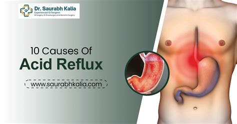10 Causes Of Acid Reflux Dr Saurabh Kalia 10 Causes Of Acid Reflux Dr Saurabh Kalia