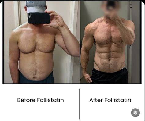 25 000 Follistatin Gene Therapy Before After Results Analysis With Peter Attia More Plates More Dates Podcast On Spotify