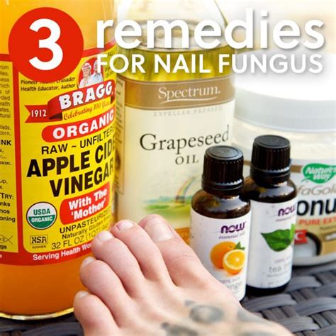 3 Simple Home Remedies For Toenail Fungus 3 Simple Home Remedies For Toenail Fungus