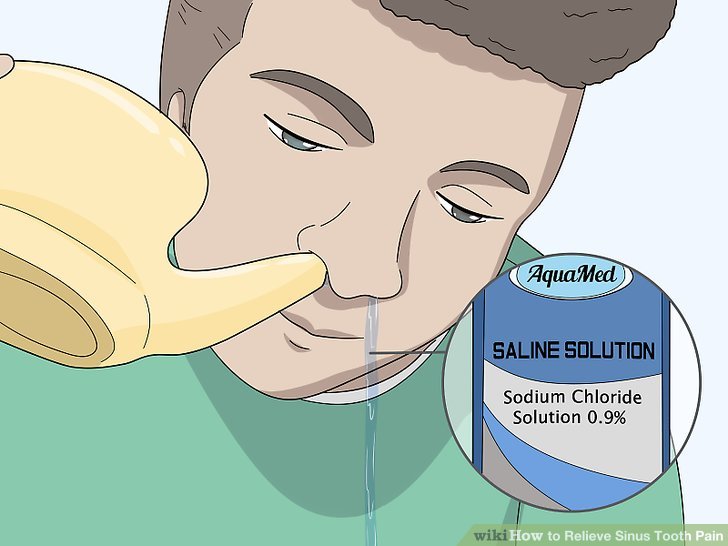 3 Ways To Relieve Sinus Tooth Pain Wikihow