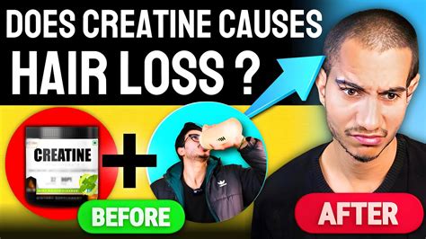 5 Essential Facts About Creatine And Hair Loss Does It Really Cause