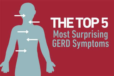 5 Surprising Gerd Symptoms To Know