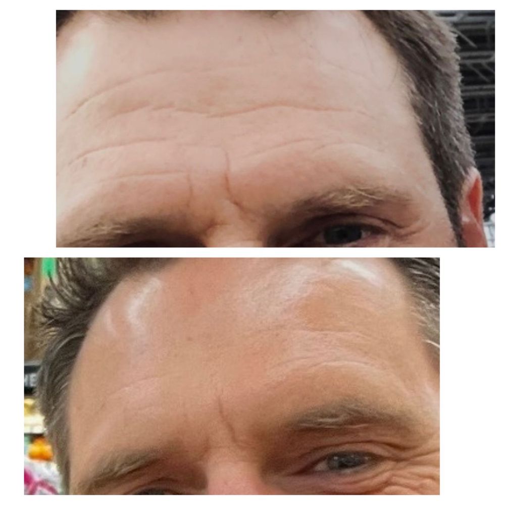 5 Ways On How To Stay Fit And Healthy Lantry Aesthetic Skin Care Center