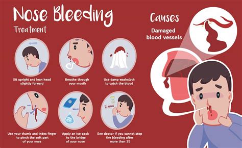 5 Ways To Prevent Nosebleeds From Stress Healthcare Associates Of Texas 5 Ways To Prevent Nosebleeds From Stress Healthcare Associates Of Texas
