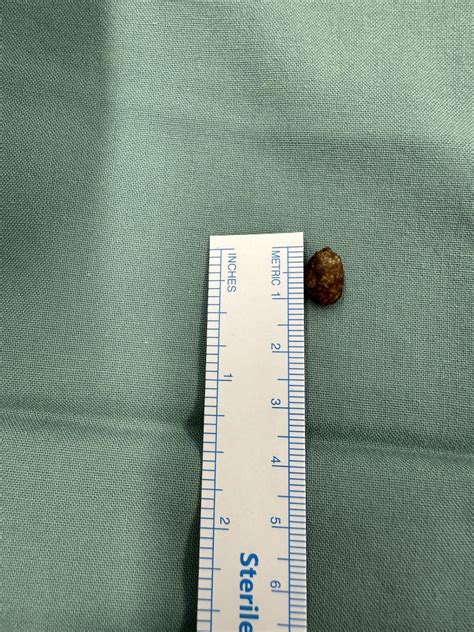 8mm to cm Converter Tips