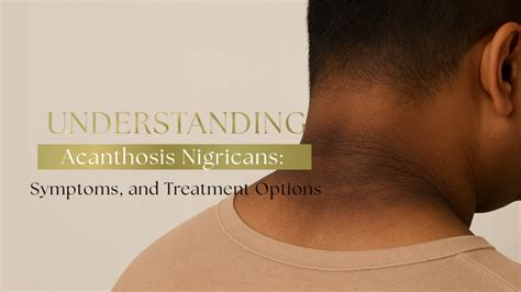 Acanthosis Nigricans Nhs
