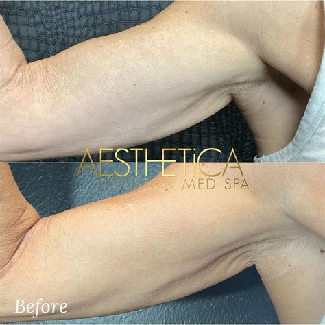 Aesthetica Houston Med Spa Updated May 2025 Request An Appointment