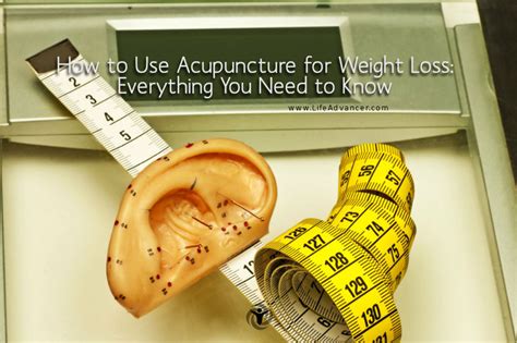 An In Depth Guide To Using Acupuncture For Weight Loss Downtownphysio