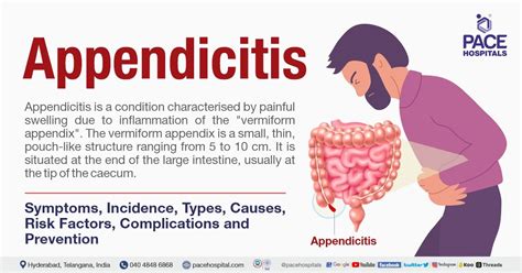 Appendicitis Symptoms, Types, Causes, Complications,, 43% Off