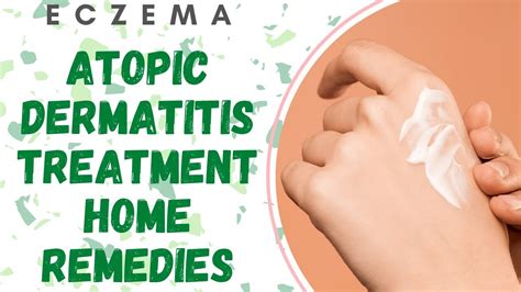 Atopic Dermatitis Or Eczema Contact Dermatitis Natural Treatment