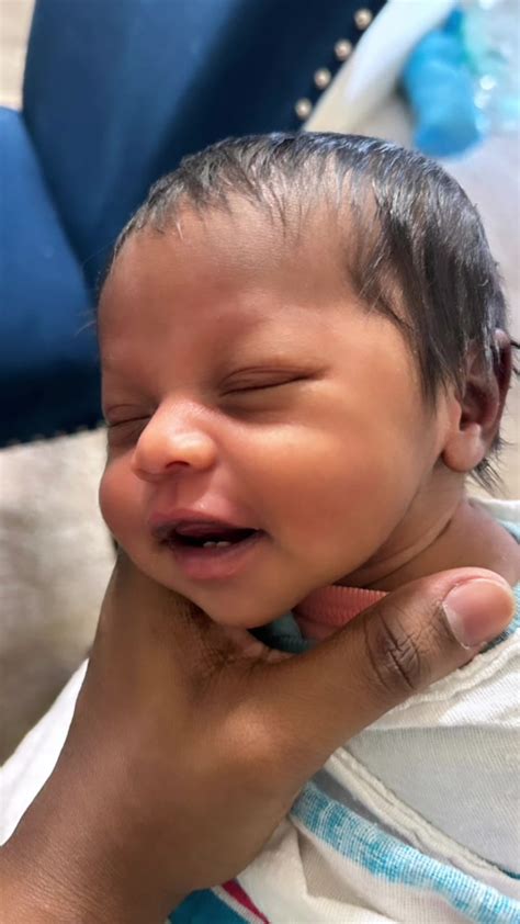 Babies Born With Teeth Not Monsters Paediatricians Insist