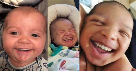 Baby Born With Teeth