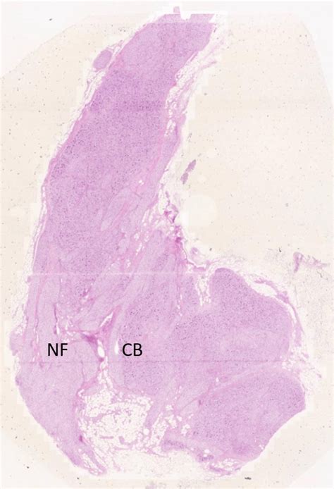 Basic Tissues Nervous Tissue Histology Education