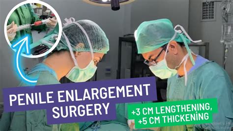 Best Enlargement Technique Penile Surgery