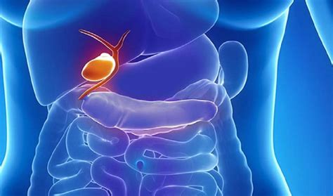 Biliary Lithiasis Medical Pharma News Modern Health And Technology News