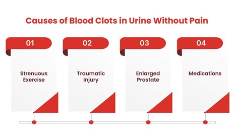 Blood Clots In Urine Symptoms And Causes Fastdocnow