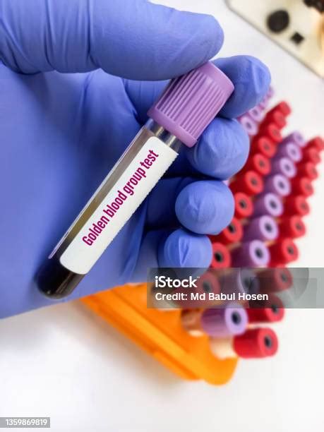 Blood Sample For Golden Blood Type Test Rh Null Blood Group Test No Rh Antigens Or Protein On The Rbc Rarest Blood Group In The World Stock Photo Download Image Now