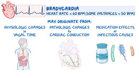 Bradycardia