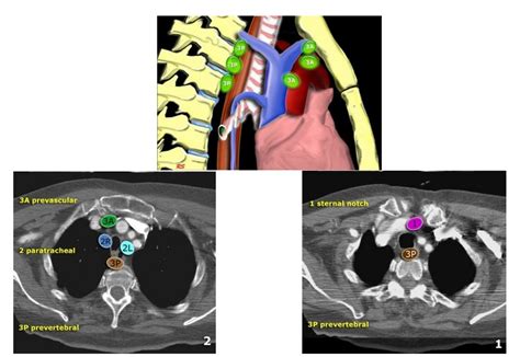 Bronchology A Well Branched Tree Intechopen