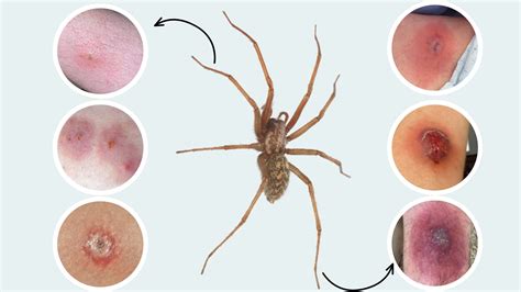 Brown Recluse Spider Everything You Need To Know Brown Recluse Spider Everything You Need To Know