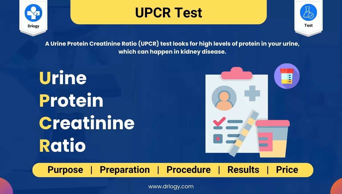 Bun Creatinine Ratio Calculator Blood Urea Nitrogen Drlogy Bun Creatinine Ratio Calculator Blood Urea Nitrogen Drlogy