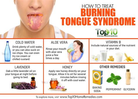 Burning Tongue Syndrome Symptoms Causes Home Remedies And Relief
