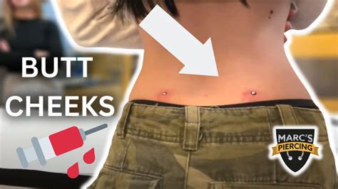 Butt Cheeks Piercing Dermal Anchors Marc S Piercing Tv Youtube