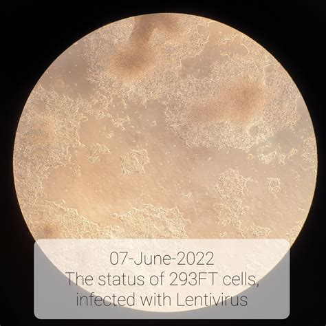 Can 293Ft Cells That Have Been Detached By Pbs Become Lentiviruses Researchgate Can 293Ft Cells That Have Been Detached By Pbs Become Lentiviruses Researchgate