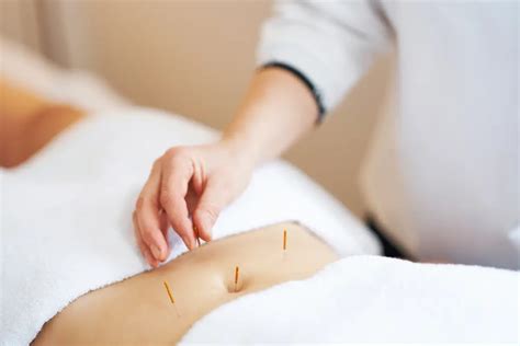 5 Ways Acupuncture Aids Weight Loss