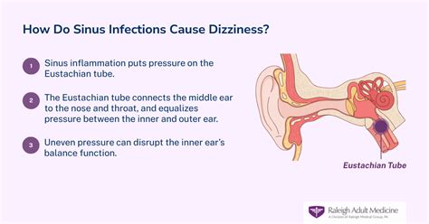 Can Sinus Infection Cause Dizziness Symptoms And Treatment