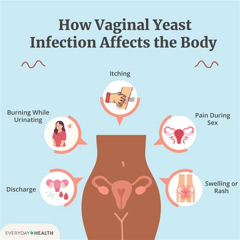 Can Yeast Infection Cause Bleeding