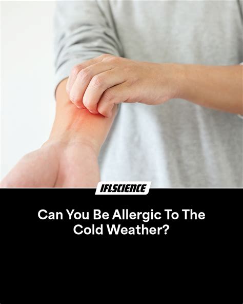 Can You Be Allergic To The Cold Weather Iflscience Can You Be Allergic To The Cold Weather Iflscience