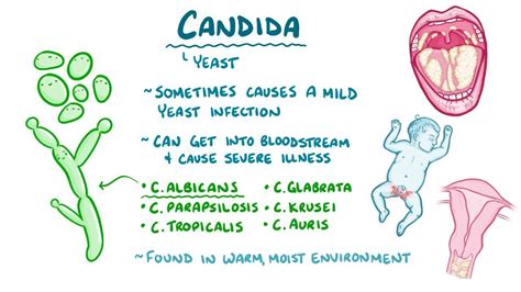 Candida Infection Pics