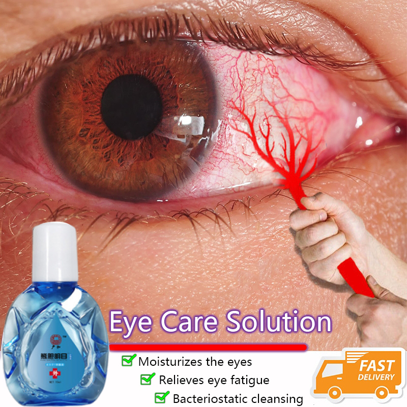 Cataract Eye Drops Eye Care Wash And Cleanse Your Eyes To Relieve Eye
