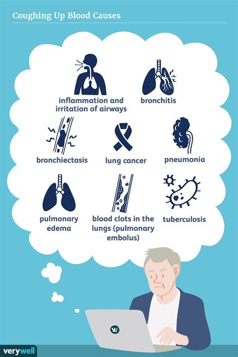 Causes Of Coughing Up Blood Nibhtbits Causes Of Coughing Up Blood Nibhtbits