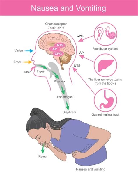 Causes Of Nausea And Vomiting