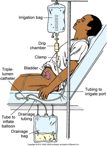 Cbi Medical Abbreviation