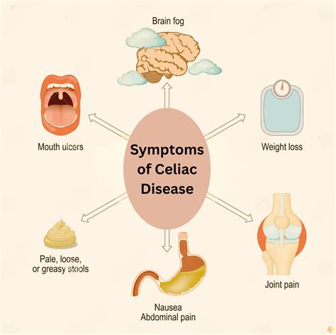Celiac Disease What You Need To Know