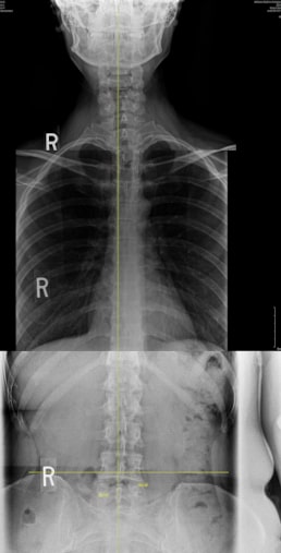 Chiropractic Schools List Of Chiropractor And Chriopractic Medicine