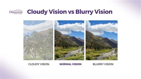 Cloudy Vision In One Eye What Does It Mean West Boca Eye Center