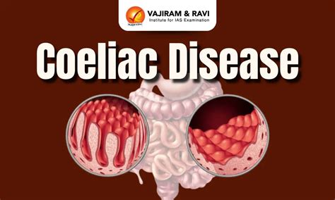 Coeliac Disease Filmfreeway