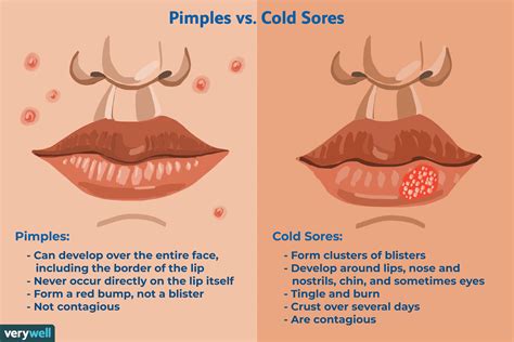 Cold Sore Or A Pimple