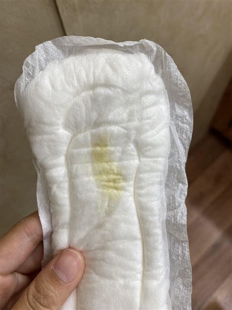 Collection 97 Pictures Pictures Of Normal Yellow Discharge Excellent