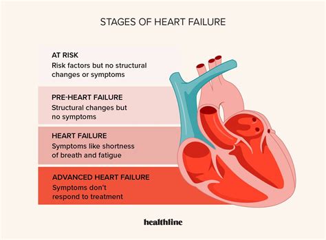 Congestive Heart Failure Symptoms Stages Treatment Diagnosis