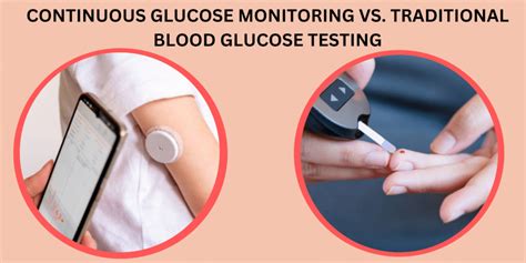 Continuous Glucose Monitoring Vs Blood Glucose Monitoring Sugar Fit
