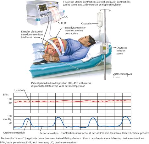 Contraction Stress Testing Clinical Tree