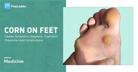 Corn Symptoms Complications And Treatment Corn Symptoms Complications And Treatment