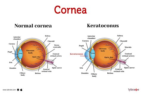 Find Top Cornea Doctors Near You Today