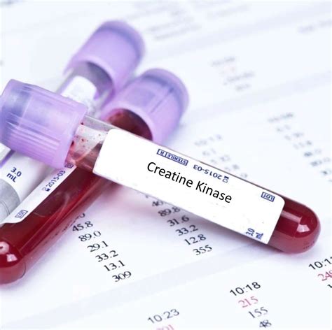 Creatine Kinase Blood Test Welzo